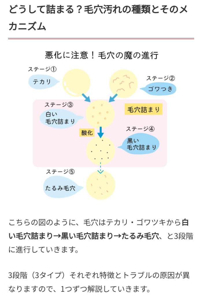 毛穴ケア