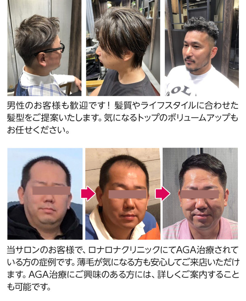 当サロンのお客様で、ロナロナクリニックにてAGA治療を受けられている方の症例です。 薄毛が気になる方も安心してご来店いただけます。 AGA治療にご興味のある方には、詳しくご案内することも可能です。